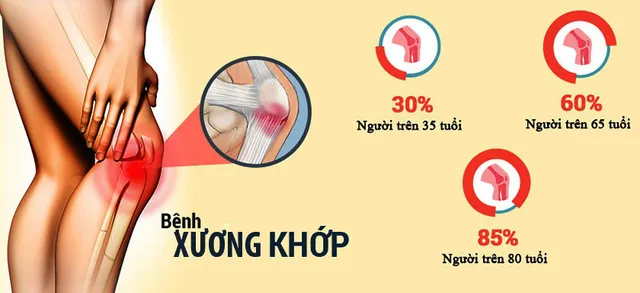 Khớp đế vương: Sản phẩm hỗ trợ điều trị bệnh xương khớp nổi tiếng - Ảnh 1.