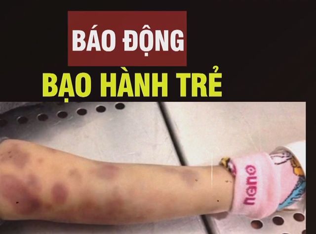 Báo động tình trạng bạo hành trẻ em - Ảnh 1.