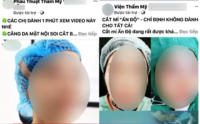 Làm đẹp ở thẩm mỹ viện không phép: Mất tiền để... mang tật? - Ảnh 1.