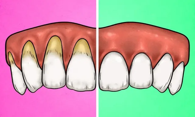 4 dấu hiệu cho thấy bạn đang đánh răng sai cách - Ảnh 1.
