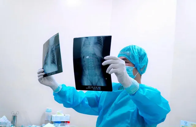 Phát hiện con nuốt đồng xu, 4 ngày sau mới đưa vào viện xử trí - Ảnh 1. Phát hiện con nuốt đồng xu, 4 ngày sau mới đưa vào viện xử trí - Ảnh 1.