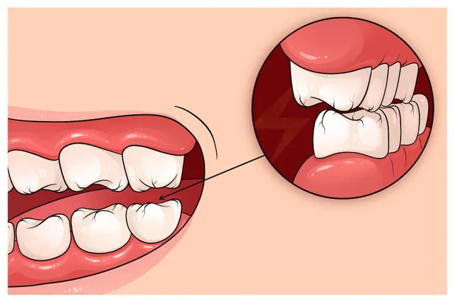 6 dấu hiệu cho thấy bạn đang bị căng thẳng liên tục mà không hề hay biết - Ảnh 1.