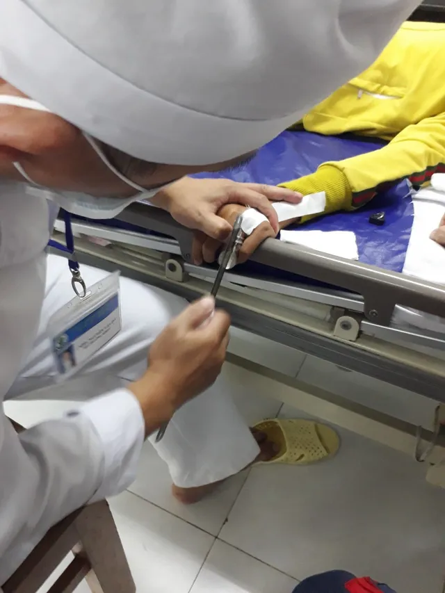 Suýt hoại tử ngón tay sau khi mua vòng kim loại trên mạng về đeo - Ảnh 1.