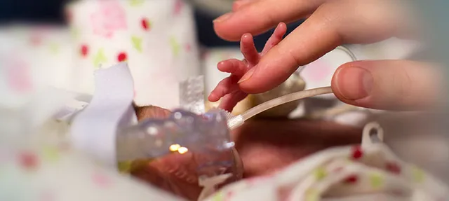 
Amplatzer Piccolo Occluder is a pea-sized, minimally-invasive device used for the treatment of PDA for premature infants and newborns
