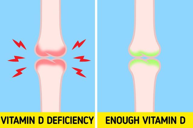 6 dấu hiệu cảnh báo cơ thể bạn đang thiếu Vitamin D trầm trọng - Ảnh 4.