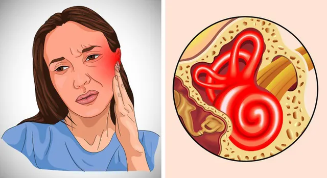 6 dấu hiệu giúp bạn nhận biết đã bị nhiễm trùng tai - Ảnh 2.