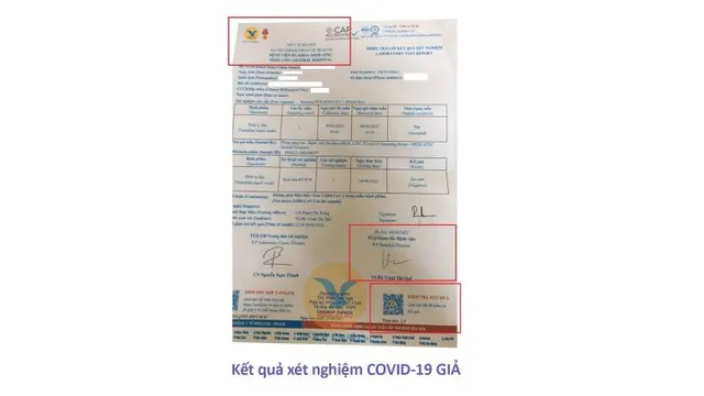 Cảnh báo: Làm giả xét nghiệm COVID-19, bán kết quả âm tính giả để xuất cảnh - Ảnh 1.