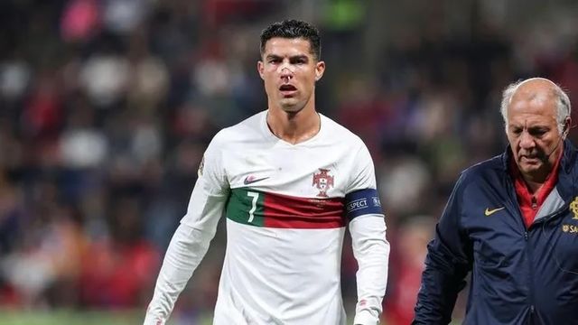 Ronaldo bị thủ môn đối phương đấm gãy mũi - Ảnh 3.