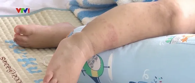Mối lo sốt xuất huyết tại Đồng bằng sông Cửu Long - Ảnh 3. Mối lo sốt xuất huyết tại Đồng bằng sông Cửu Long - Ảnh 3.