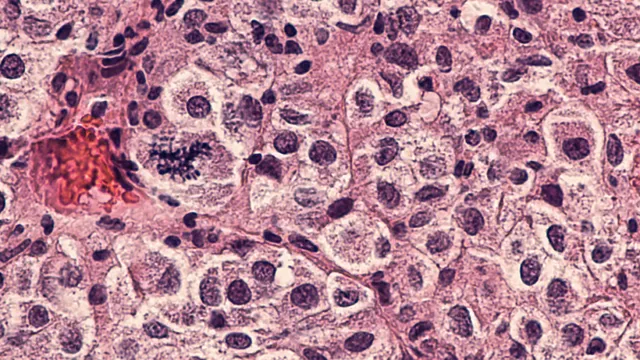 Thế giới sắp có vaccine điều trị ung thư - Ảnh 6. Thế giới sắp có vaccine điều trị ung thư - Ảnh 6.