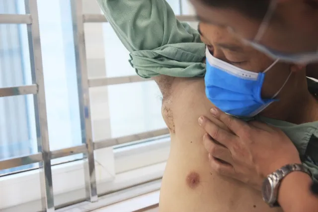 Người đàn ông mắc bệnh mèo cào hiếm gặp - Ảnh 1. Người đàn ông mắc bệnh mèo cào hiếm gặp - Ảnh 1.