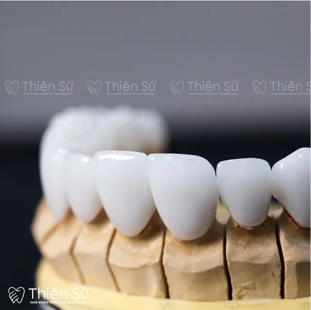Nha khoa Thiên Sứ: Hướng tới các giá trị bền vững - Ảnh 2. Nha khoa Thiên Sứ: Hướng tới các giá trị bền vững - Ảnh 2.