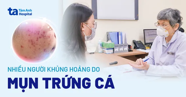 Nhiều người khủng hoảng do mụn trứng cá - Ảnh 1.