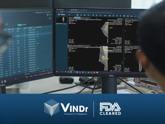 Sản phẩm AI của VinBigdata đạt chứng nhận của FDA, chính thức tiến vào thị trường Mỹ - Ảnh 1.