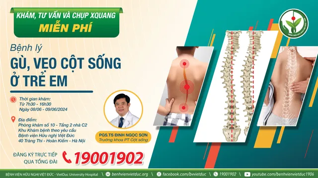 Khám sàng lọc, tư vấn miễn phí gù vẹo cột sống ở trẻ em - Ảnh 1.