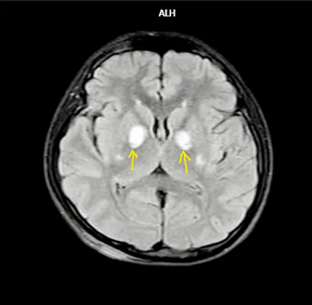 Cảnh báo những nguy cơ mới gây ngộ độc khí CO từ các thiết bị hiện đại - Ảnh 2.