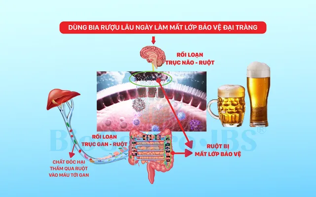 Cải thiện triệu chứng hội chứng ruột kích thích, bệnh tiêu hóa khi uống bia rượu - Ảnh 1.