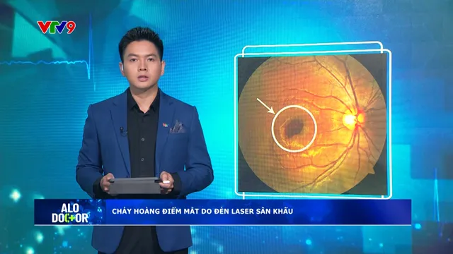 Alo Doctor (10/01/2025): Cháy hoàng điểm mắt do đèn laser sân khấu