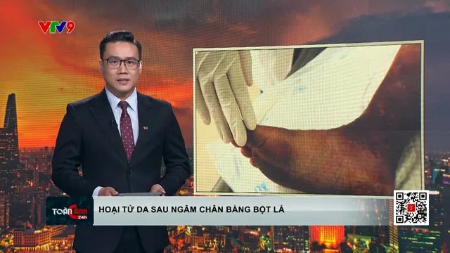 Hoại tử da sau khi ngâm chân với loại bột lá