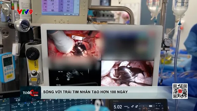 Người đầu tiên sống với trái tim nhân tạo hơn 100 ngày