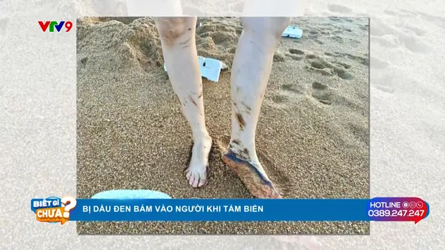 Bị dầu đen bám vào người khi tắm biển