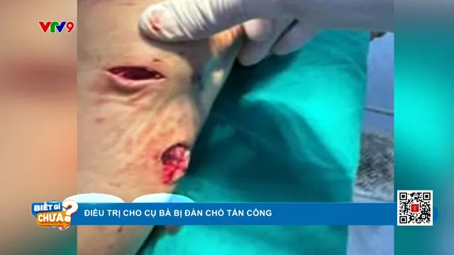 Điều trị cụ bà bị đàn chó tấn công