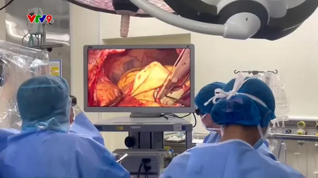 Alo Doctor (21/5/2025): Phẫu thuật thay đồng thời 2 van tim