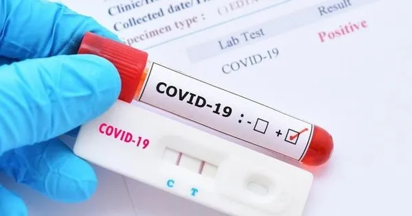 Kit test và thuốc điều trị COVID-19 được bán tràn lan trên mạng