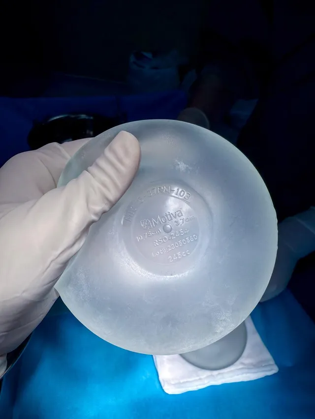 How long should you stop taking supplements before breast augmentation? - Ảnh 4.