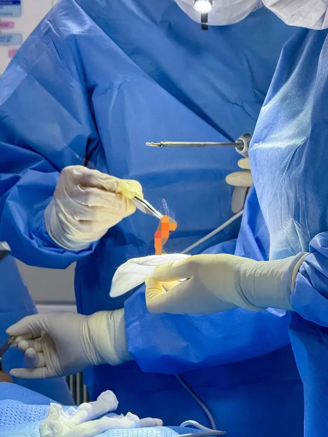 How long should you stop taking supplements before breast augmentation? - Ảnh 3.