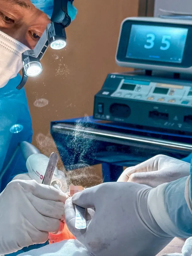 Recurrent Breast Ptosis: Signs, Challenges, and Treatment - Ảnh 4.