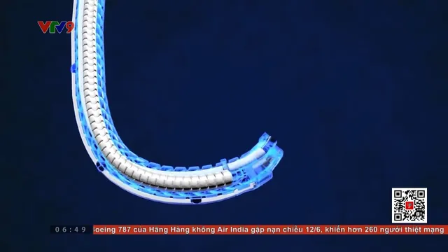 Robot hình rắn - Cuộc cách mạng trong công tác kiểm tra và bảo trì thiết bị chính xác
