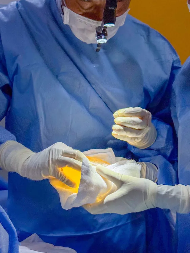 Breast Augmentation Complications: Capsular Contracture, Implant Rupture, Infection - Ảnh 5.