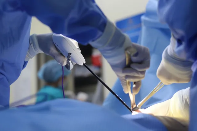 What Is Mastopexy Using the Harmonic Scalpel?  - Ảnh 2.