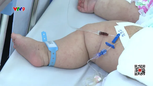 Sốt xuất huyết tăng cao, các bệnh viên tăng cường điều trị