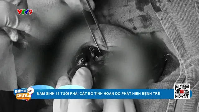 Bé 15 tuổi phải cắt bỏ tinh hoàn do phát hiện muộn