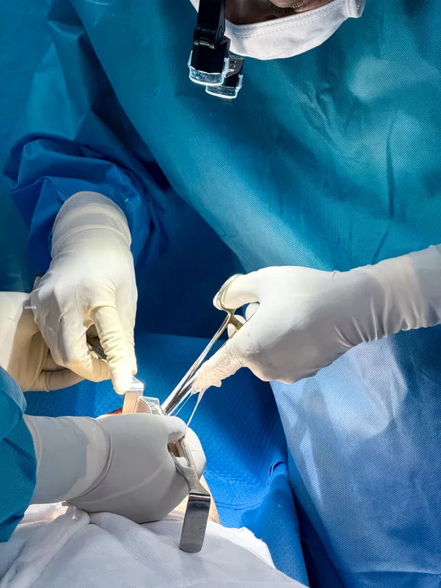 What Is Breast Implant Rupture? - Ảnh 1.