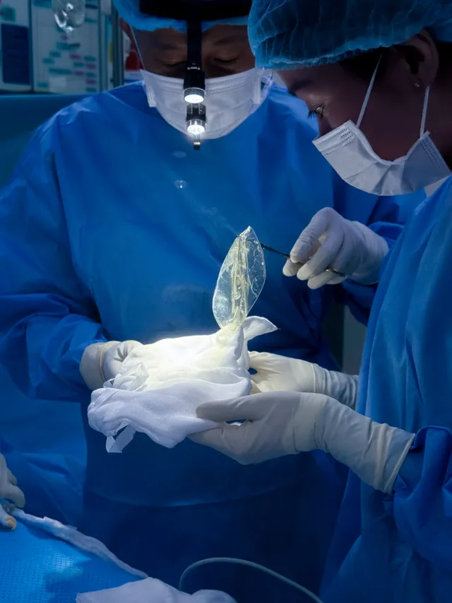 What Is Breast Implant Rupture? - Ảnh 2.