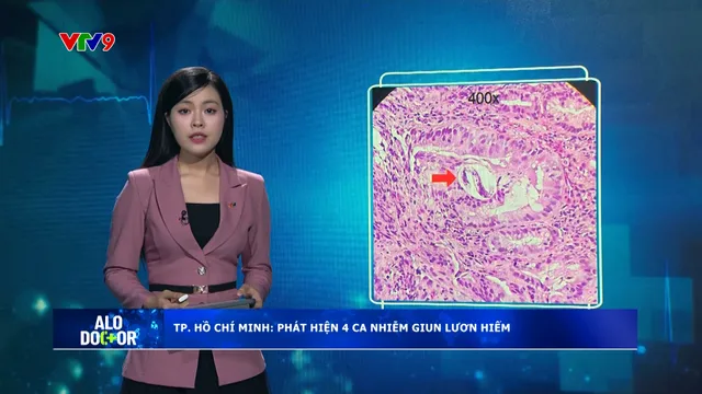 Alo Doctor (26/6/2025):  Bệnh viện TP. Hồ Chí Minh phát hiện 4 ca nhiễm giun lươn hiếm