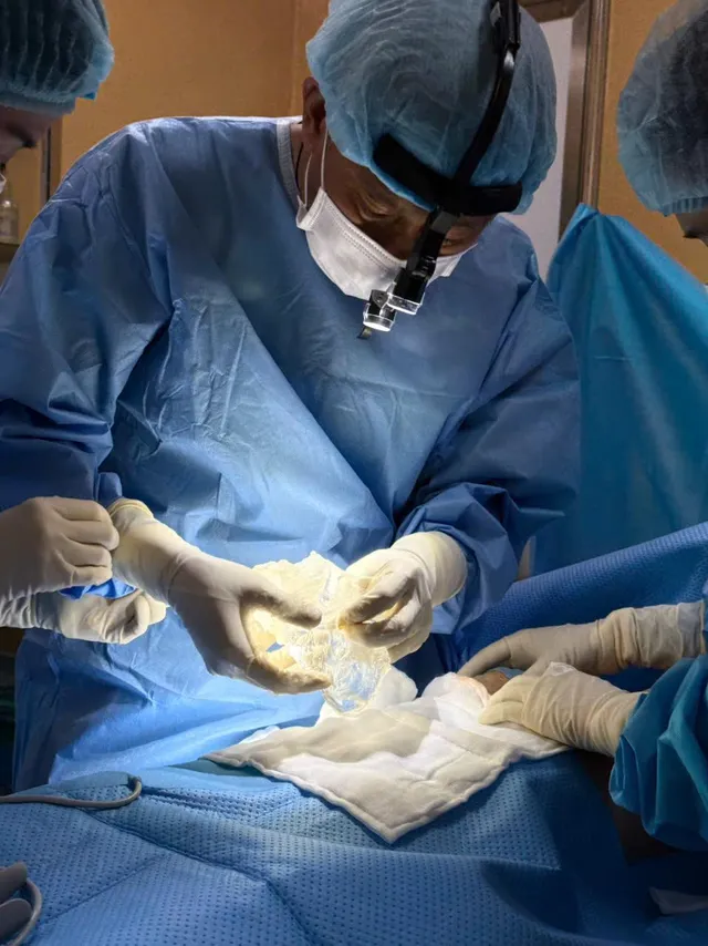 What is recurrent capsular contracture? - Ảnh 4.