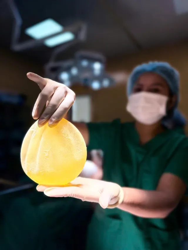 What is recurrent capsular contracture? - Ảnh 2.