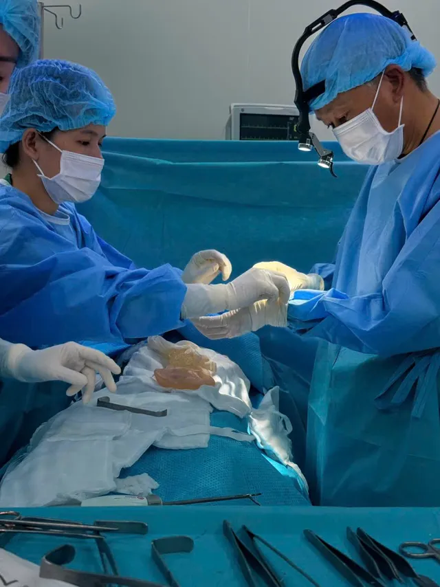 What is recurrent capsular contracture? - Ảnh 3.