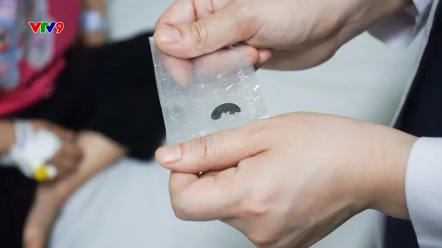Alo Doctor (01/7/2025): Trẻ hóc dị vật hơn 2 tháng