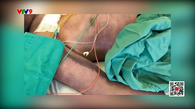 Nguy hiểm khi sử dụng tiết canh, lòng lợn