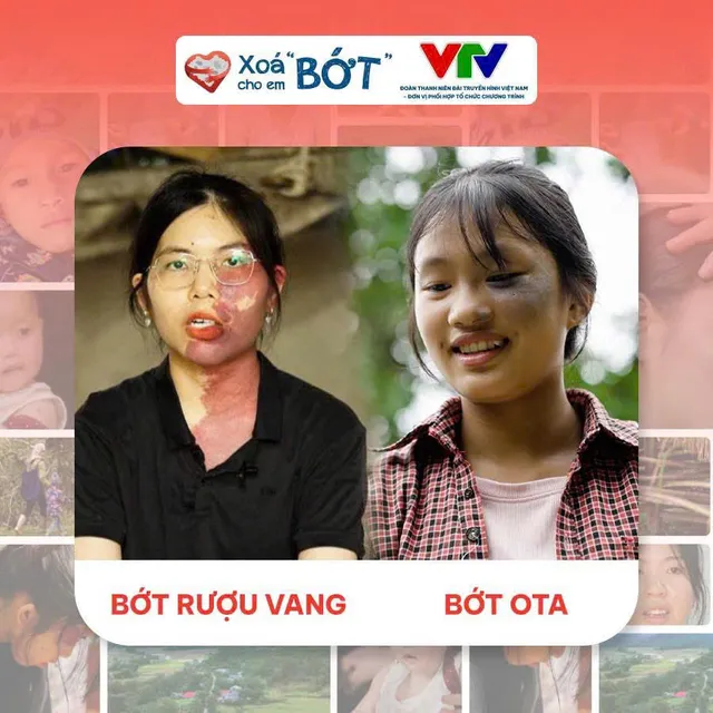 Đoàn Thanh niên Đài Truyền hình Việt Nam chính thức đồng hành cùng Xóa “bớt” cho em - Ảnh 4.