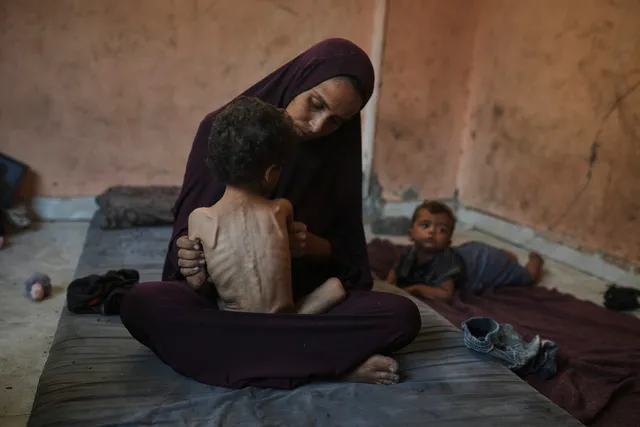 Liên hợp quốc cảnh báo viện trợ vào Gaza không đủ, trẻ em đối mặt suy dinh dưỡng nghiêm trọng - Ảnh 1.