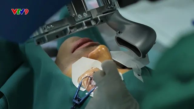 Ứng dụng A.I trong điều trị đục thủy tinh thể