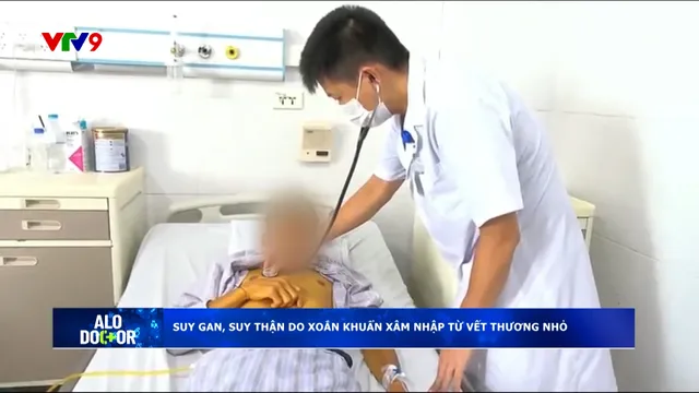Alo Doctor (31/7/2025): Suy gan, suy thận do xoắn khuẩn xâm nhập từ vết thương nhỏ
