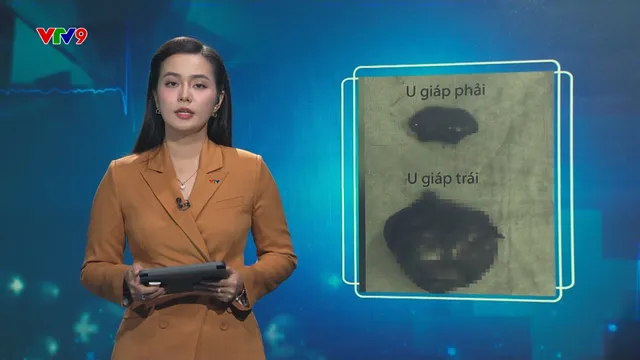 Alo Doctor (12/8/2025): Suýt mất mạng vì chủ quan với u tuyến giáp lành tính