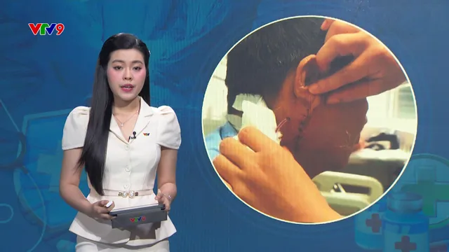 Alo Doctor (04/9/2025): Nguy cơ liệt mặt do u tuyến nước bọt